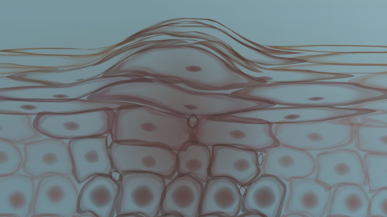 Blog Post Image